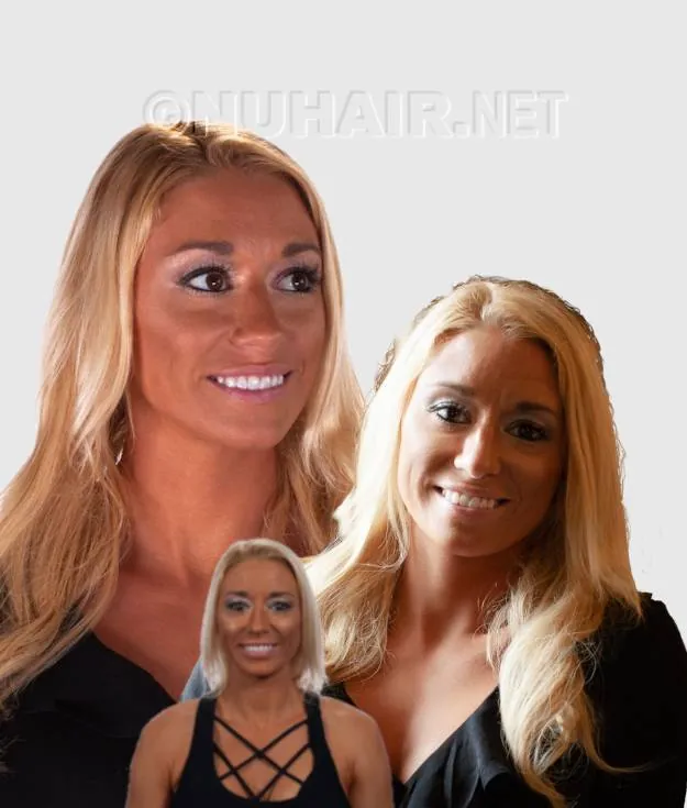 Ashley — hair restoration result, Nu Hair of Texas