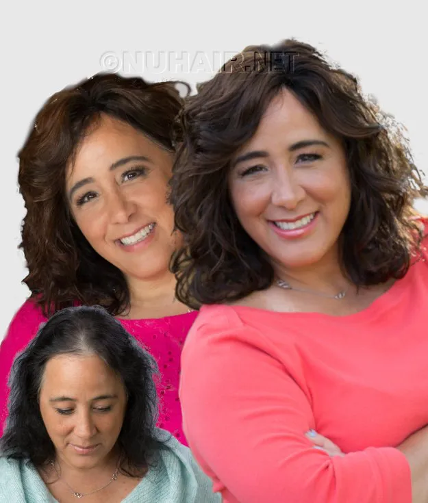 Crysta — hair restoration result, Nu Hair of Texas