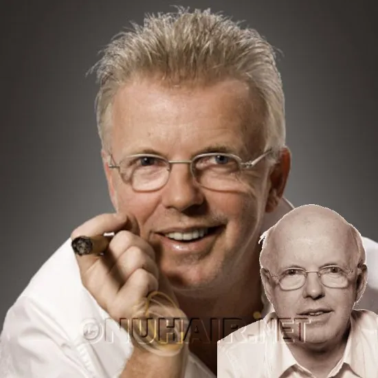 Jurgen — hair restoration result, Nu Hair of Texas