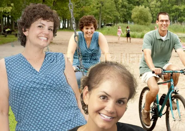 Female Hair Loss Treatment Hair Replacement Dallas, TX