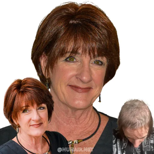 Loretta — hair restoration result, Nu Hair of Texas