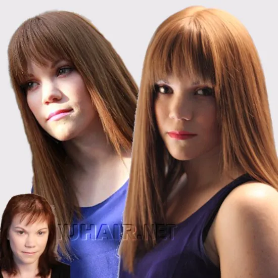 Maddie — hair restoration result, Nu Hair of Texas