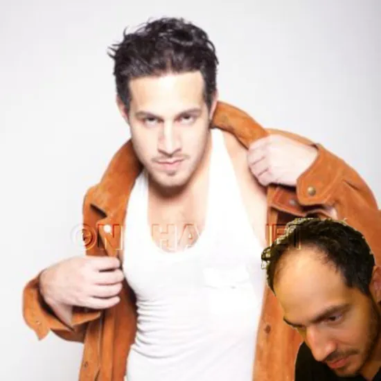 Men Hair Replacement Hair System DFW TX