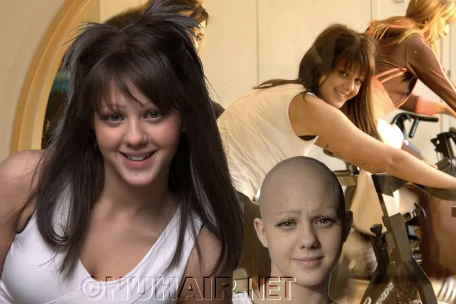 Alopecia Areata Hair Loss Medical Wig Dallas, TX