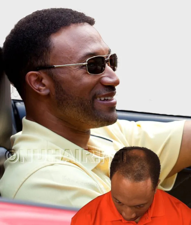 Mike — hair restoration result, Nu Hair of Texas