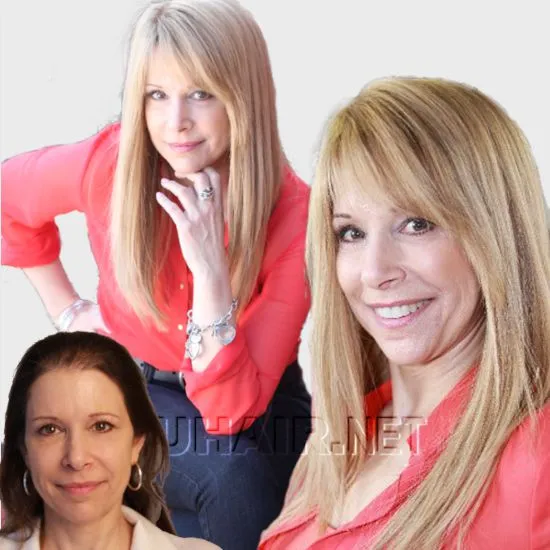 Nancy — hair restoration result, Nu Hair of Texas
