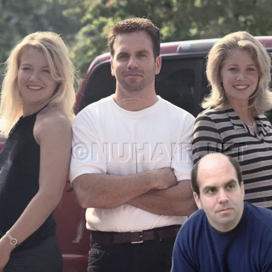 Paul — hair restoration result, Nu Hair of Texas