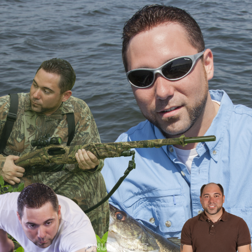 Best Hair Restoration for Balding Men's Hair Replacement System Dallas, TX
