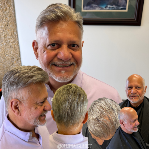 Arnold Ochoa — men's hair restoration result, Nu Hair of Texas