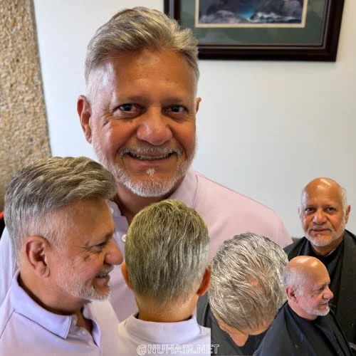 Arnold Ochoa — men's hair restoration result, Nu Hair of Texas