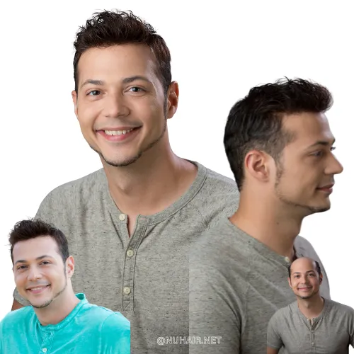 Men's Hair Restoration for Baldness Dallas TX