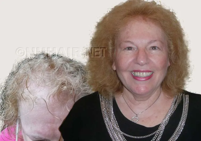 Esther laser hair growth treatment Dallas DFW
