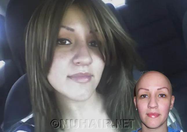 Jennifer alopecia medical wig, Dallas best wigs