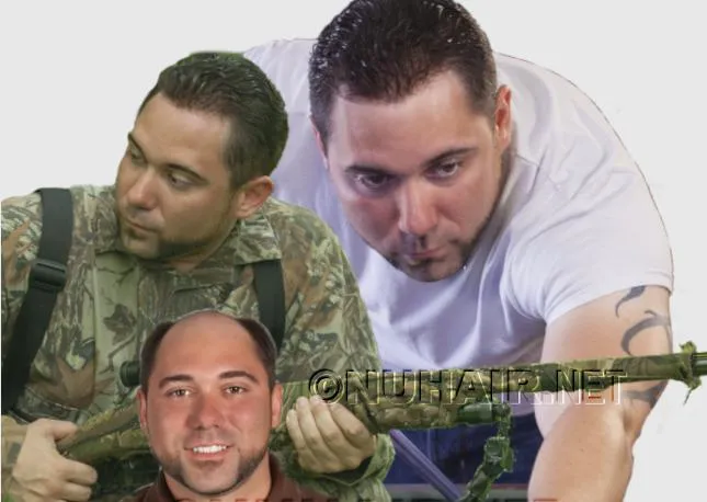 Hair Replacement Men Hair Loss Treatment Dallas