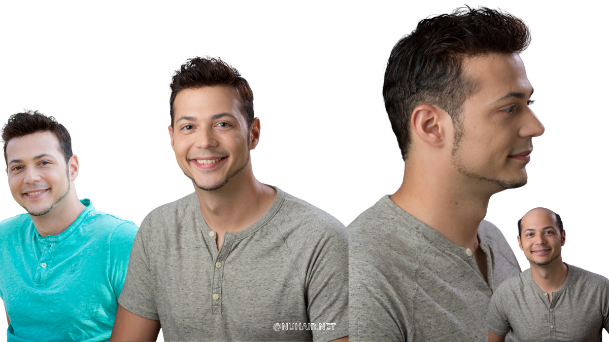 Nu Hair of Texas Non-Surgical Hair Restoration Best Option Review Bryan Dallas DFW TX