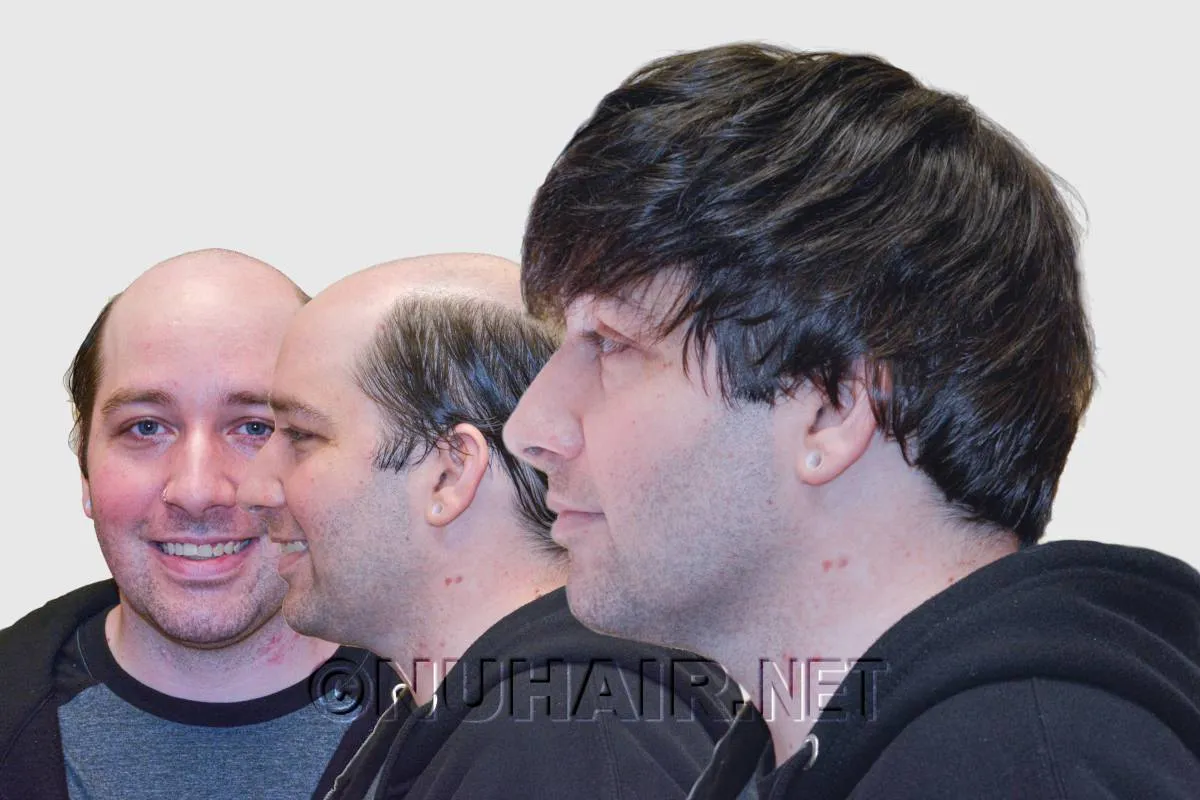 Hair Loss Men's Hair Restoration USA — Nu Hair of Texas hair loss facts & statistics
