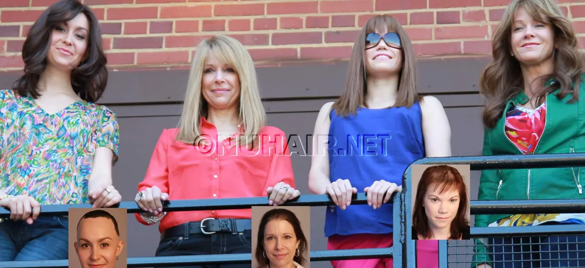 Women's Hair Loss Help Dallas TX