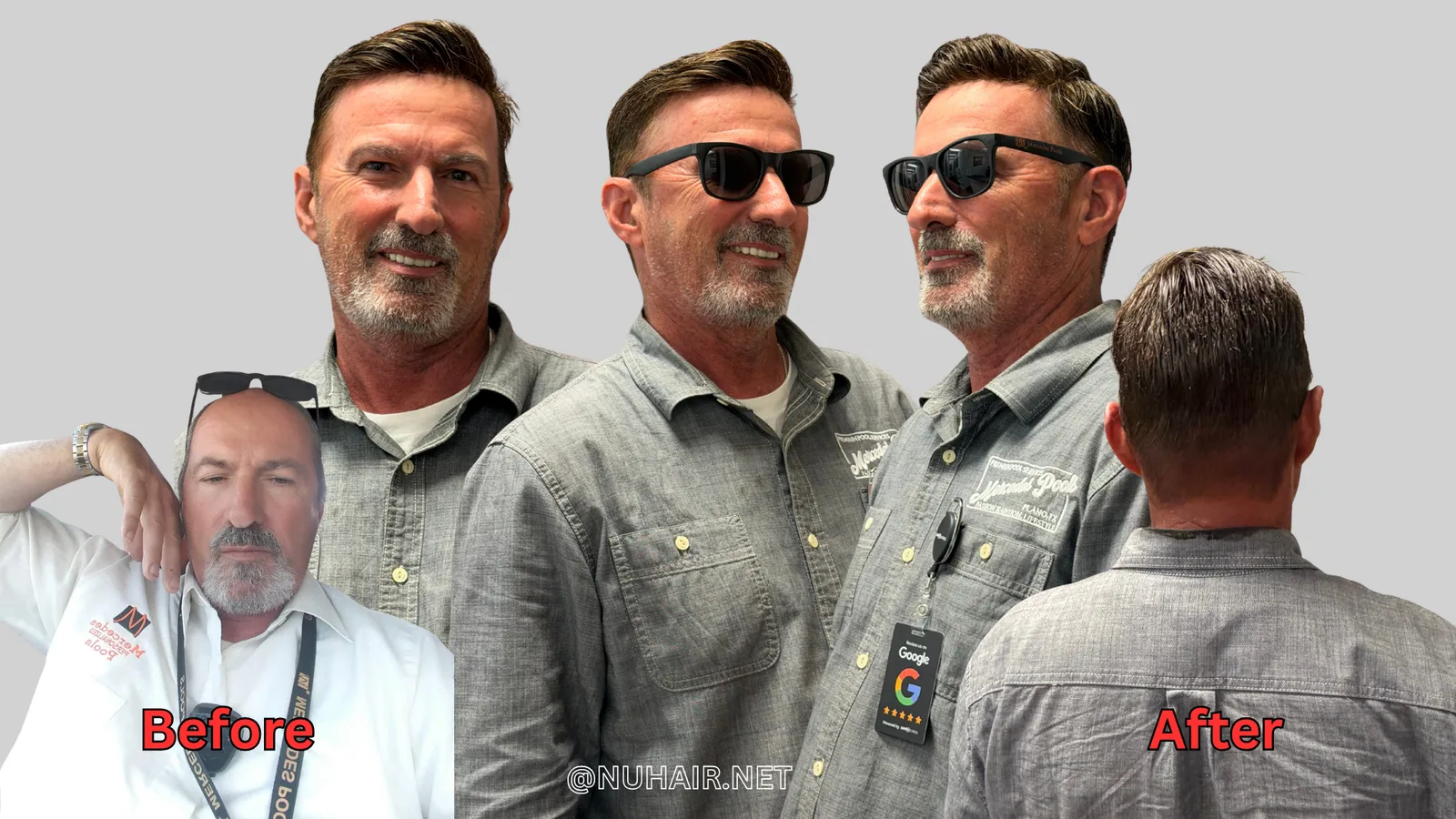 David Dixon before and after: men's hair replacement system at Nu Hair of Texas, Dallas