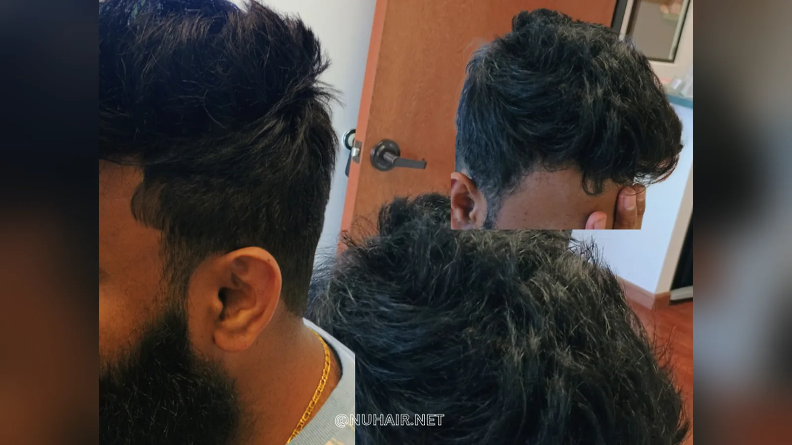 Dev's stylish men's hair system with thicker-looking hair, Nu Hair of Texas, Dallas