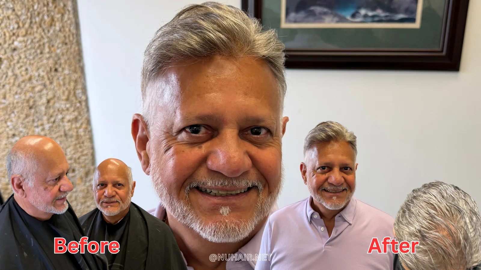 Arnold Ochoa before and after: men's hair system transformation at Nu Hair of Texas, Dallas