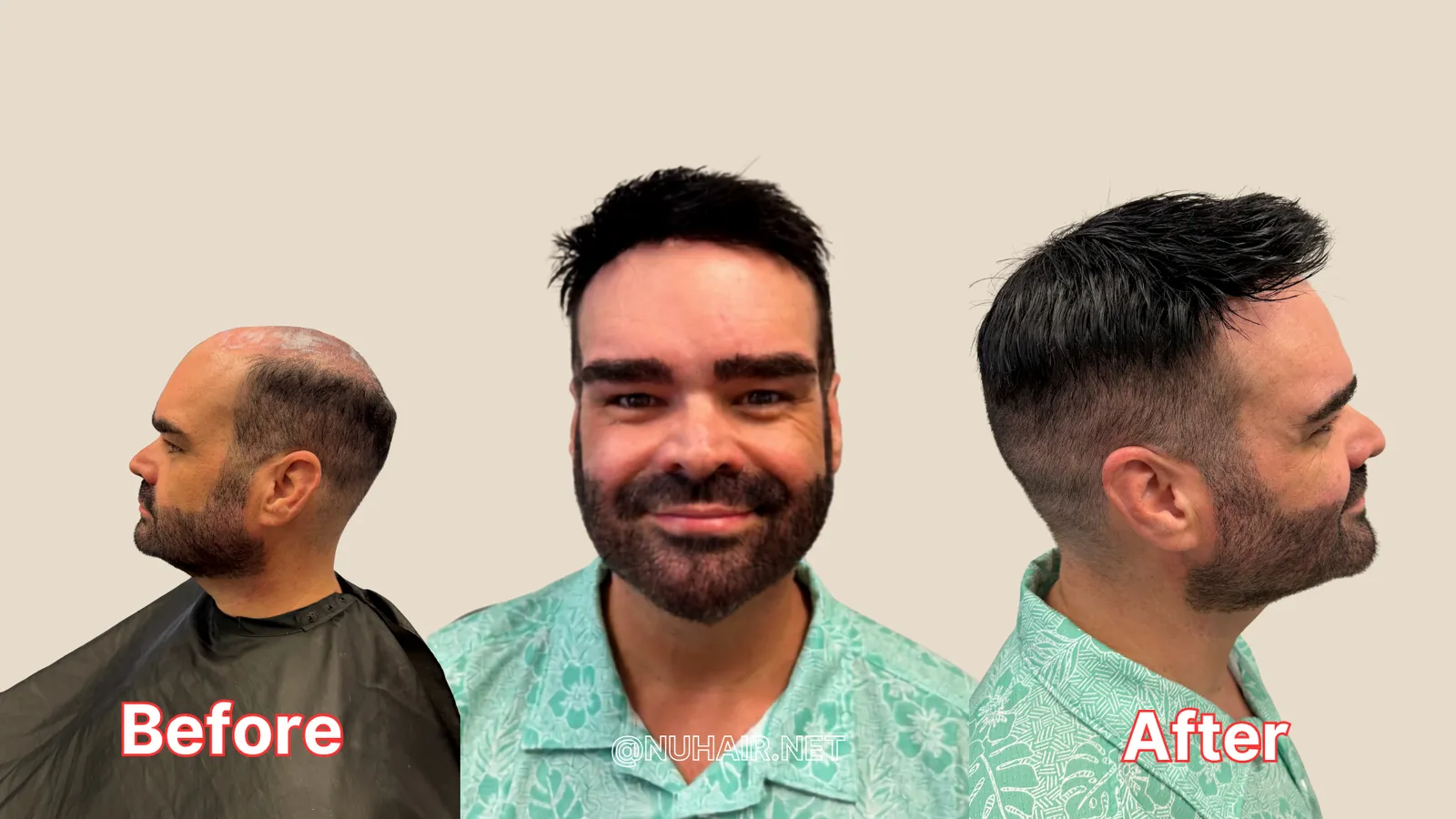 Chris C. before and after: men's hair loss transformation with a custom human hair system at Nu Hair of Texas, Dallas