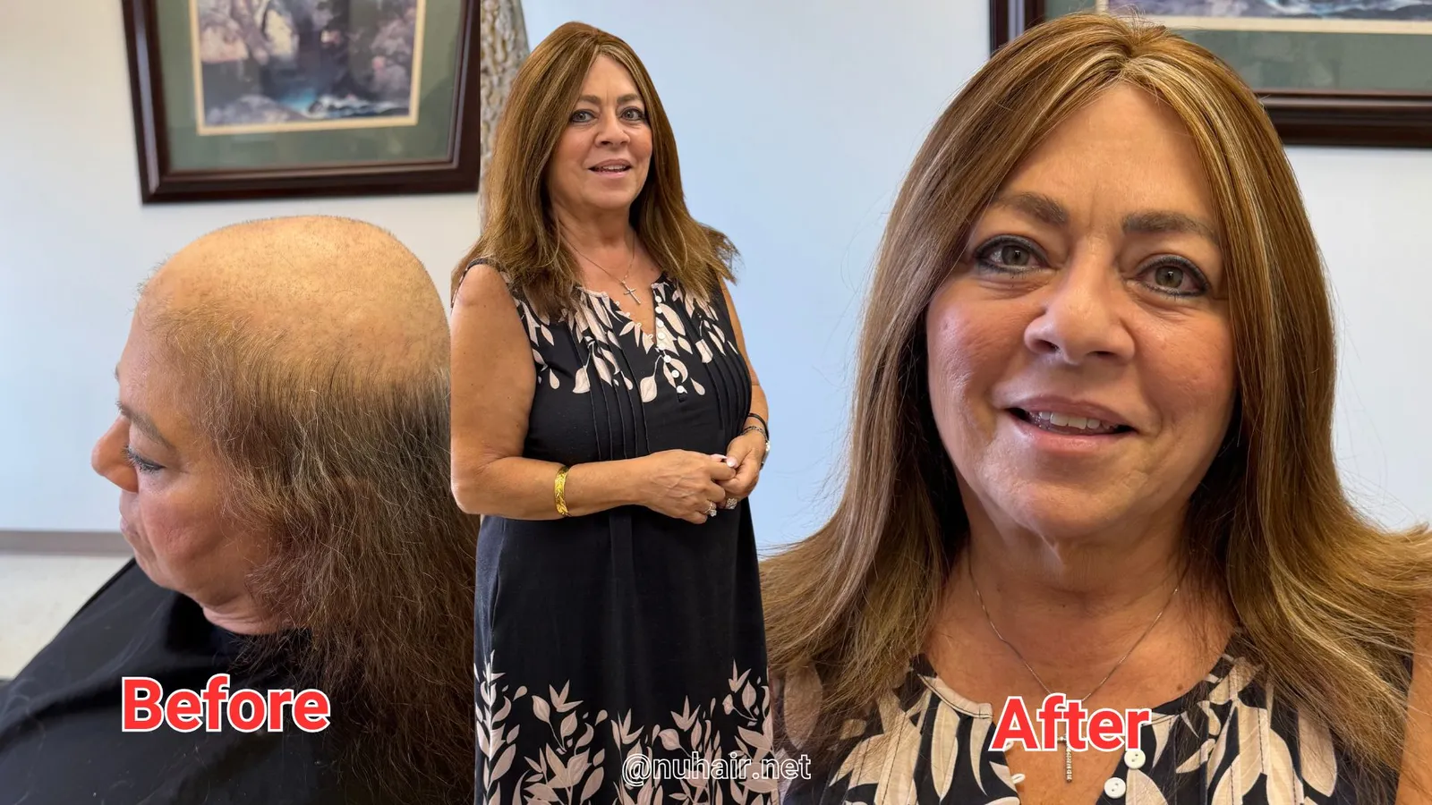 Renee before and after: women's hair loss transformation with a custom human hair system at Nu Hair of Texas, Dallas