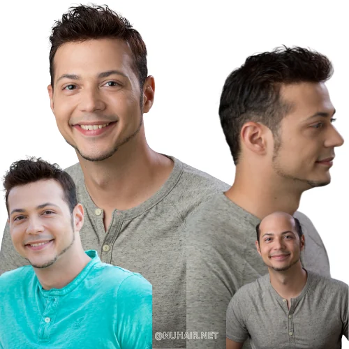 Bryan — men's hair restoration result, Nu Hair of Texas