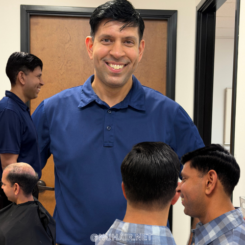 Chris Brewer — nonsurgical hair restoration before and after result, Nu Hair of Texas
