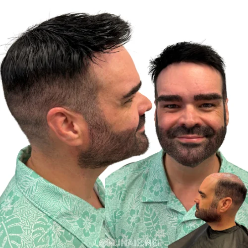 Chris Conner — men's hair system result, Nu Hair of Texas