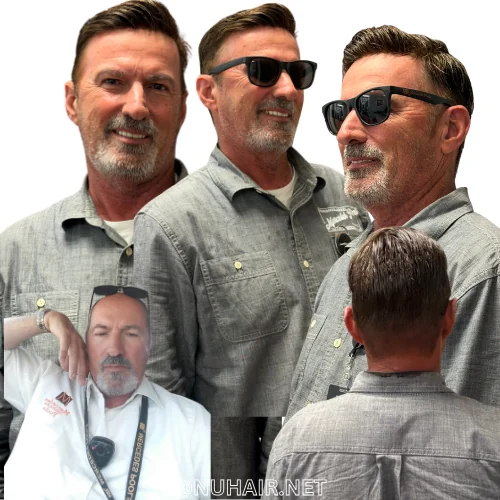 David Dixon — men's hair restoration result, Nu Hair of Texas