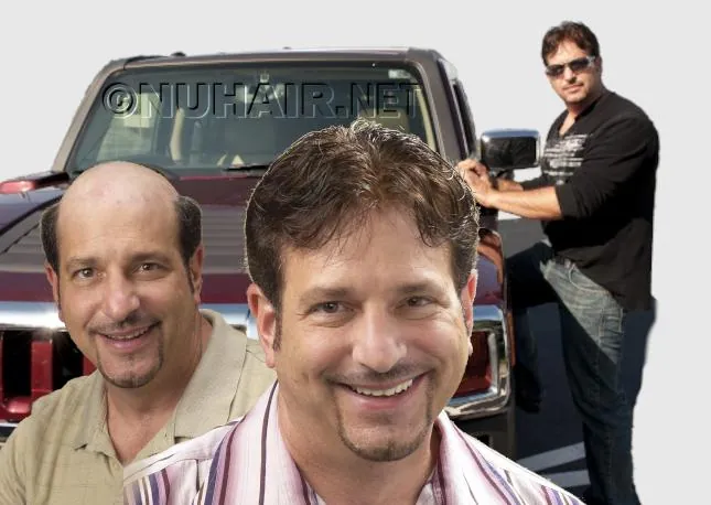 Man Hair Restoration Hair Care Dallas TX Complete Privacy