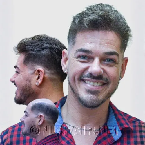 Elliott — nonsurgical hair restoration result shown from the side, front, and back, Nu Hair of Texas
