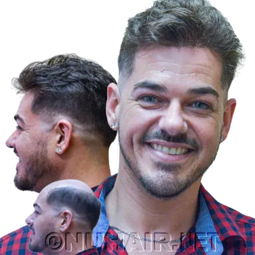 Elliott — men's hair restoration result, Nu Hair of Texas