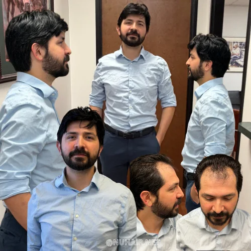 Eric De La Rosa — men's hair system result, Nu Hair of Texas
