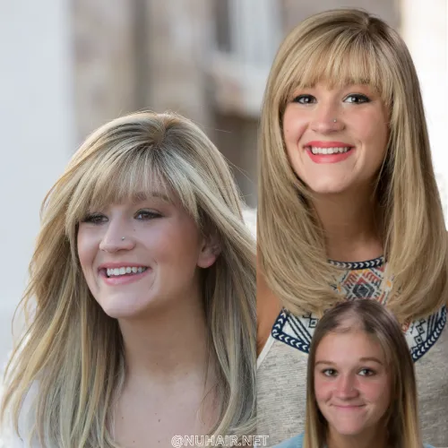 Female hair loss — hair restoration result, Nu Hair of Texas