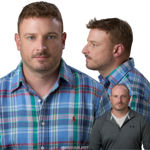 Jesse — men's hair restoration result, Nu Hair of Texas