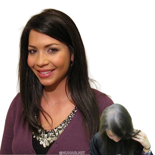 Julie — women's hair restoration result, Nu Hair of Texas
