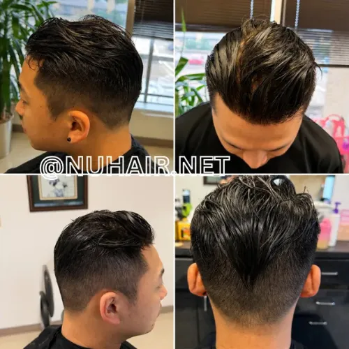 Kevin Lin — nonsurgical hair restoration result shown from multiple angles, Nu Hair of Texas