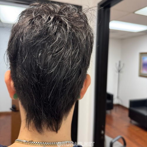 Laura R — women's hair restoration result, Nu Hair of Texas