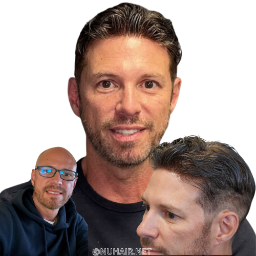 Michael — hair restoration result, Nu Hair of Texas