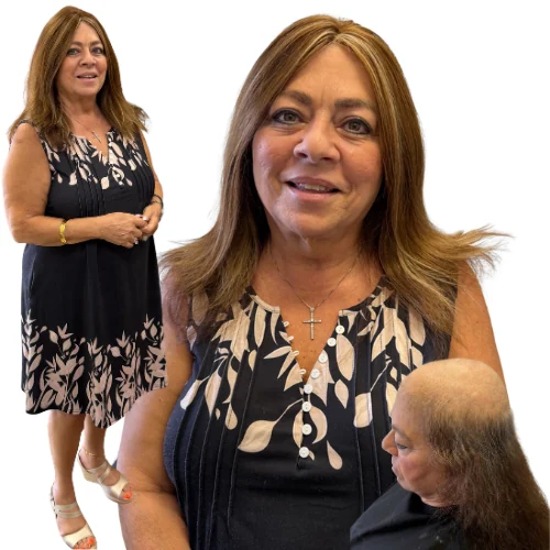 Renee — women's hair restoration result, Nu Hair of Texas