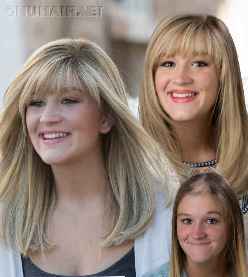 Female Hair Loss Kids Wigs in Dallas TX