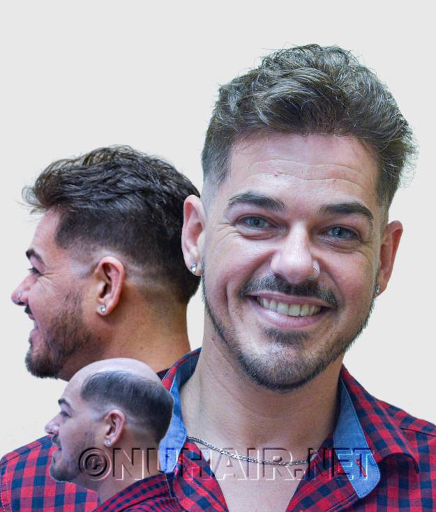 Men's Hair Replacement System Hairstyle DFW Dallas, TX