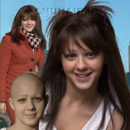 Human Hair Alopecia Wig Dallas TX Before & After Photo